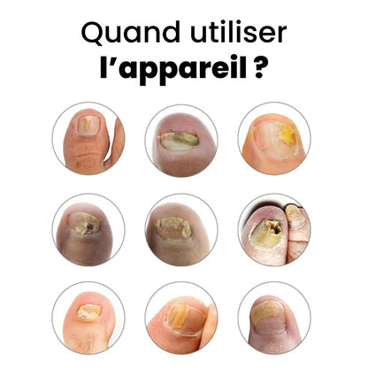 Appareil OnyCare